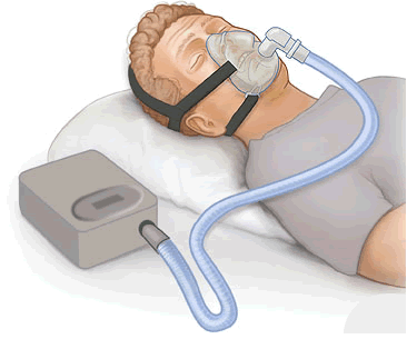 CPAP Respiratory On Rent in Ghaziabad